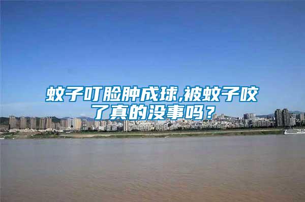 蚊子叮臉腫成球,被蚊子咬了真的沒(méi)事嗎？